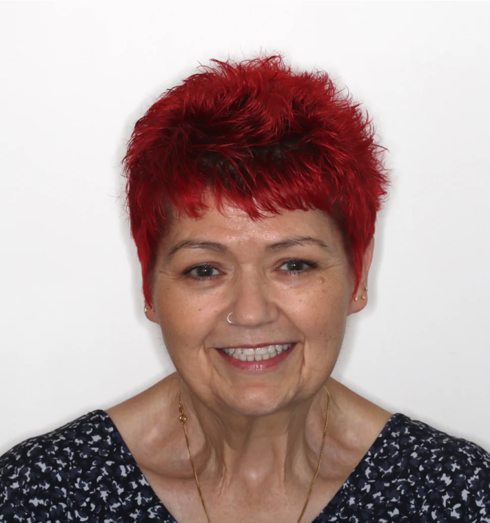 photograph of dental implant patient
