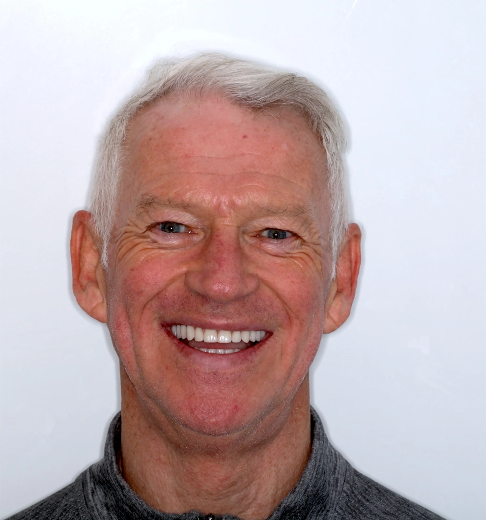 Dr. Nadeem Sabir discussing dental implant fees with patient